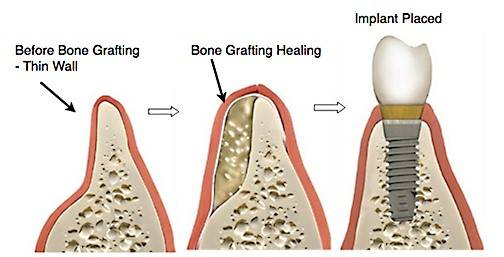 Dr Erum Khan initiates Tissue Engineering at Institute of Dentistry, LUMHS