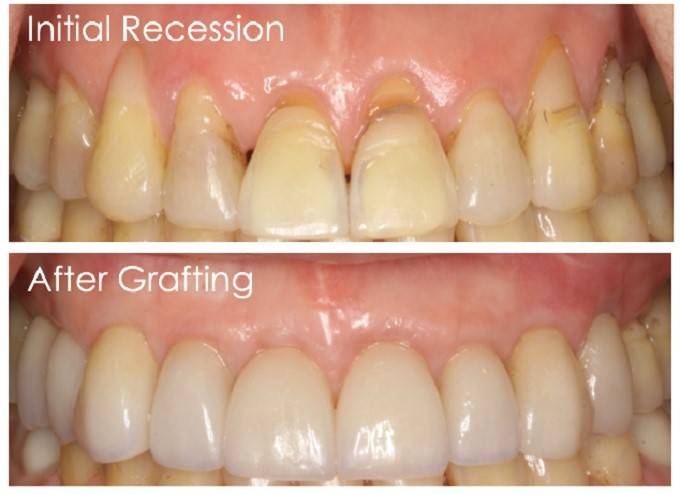 Dr Erum Khan initiates Tissue Engineering at Institute of Dentistry, LUMHS