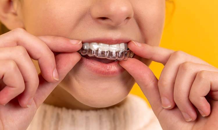 SSCMS explains the importance of fixed braces and clear aligners