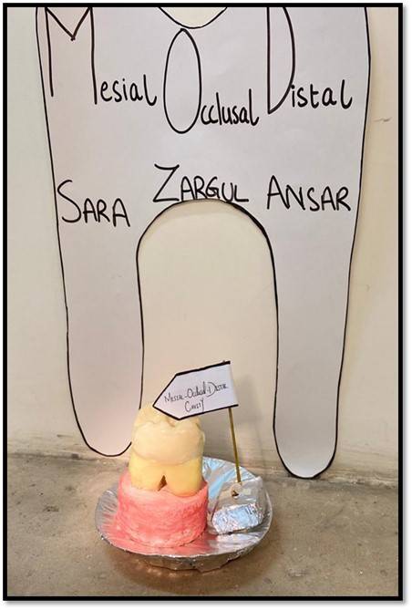 BUMDC students depict dental cavities on models  