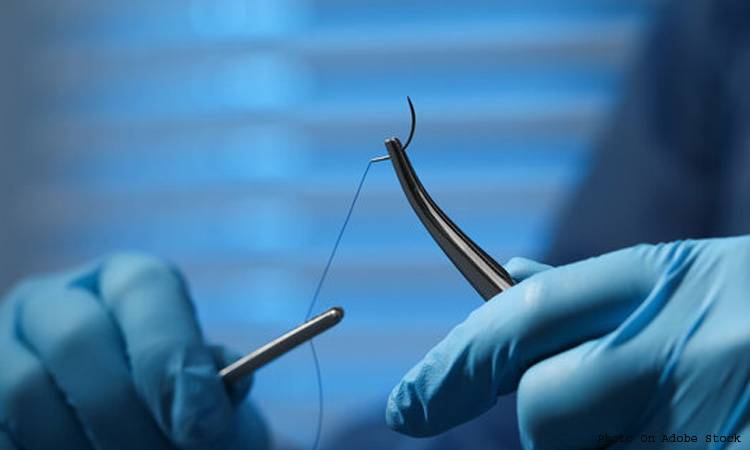 Dental Sutures: Application, Care and Removal