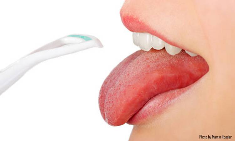 Tongue and Your Health: Here is Why You Should Concern