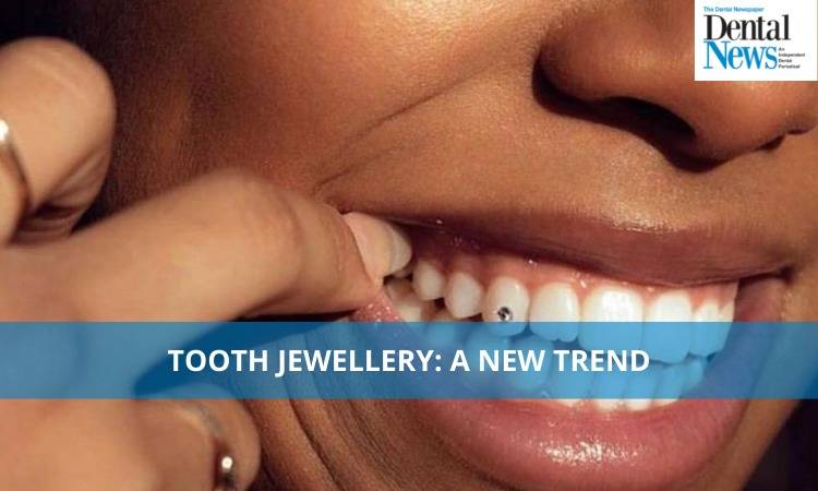 Tooth Jewellery: A New Trend