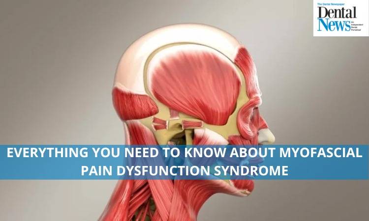 Everything You Need To Know About Myofascial Pain Dysfunction Syndrome