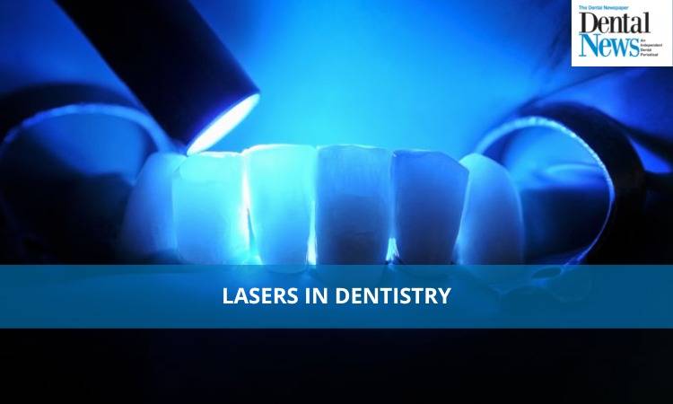 Lasers In Dentistry