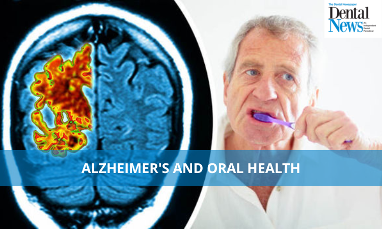 Alzheimer’s and Oral Health