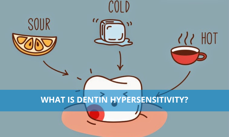 What is Dentin Hypersensitivity?