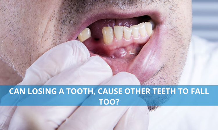 Can losing a tooth, cause other teeth to fall too?