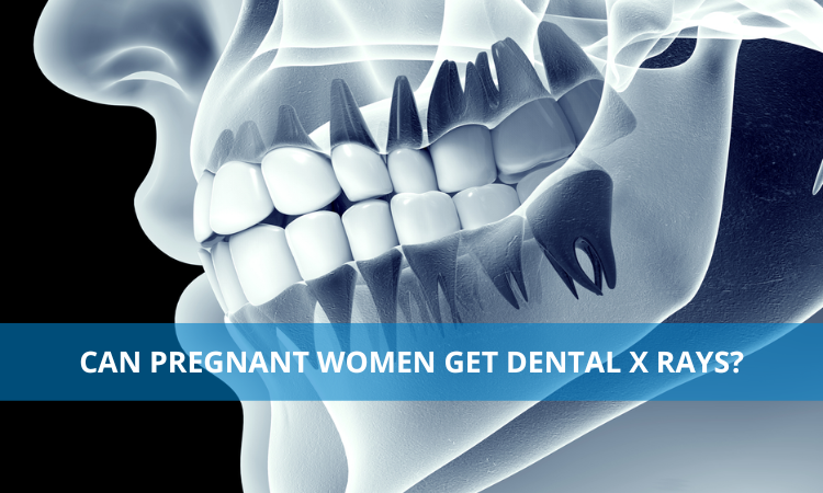 Can Pregnant Women Get Dental X rays?