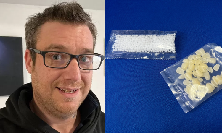 Man from Bridlington repairs tooth with super glue 