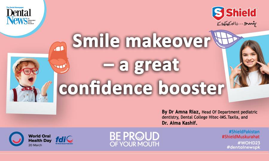 Smile makeover – a great confidence booster