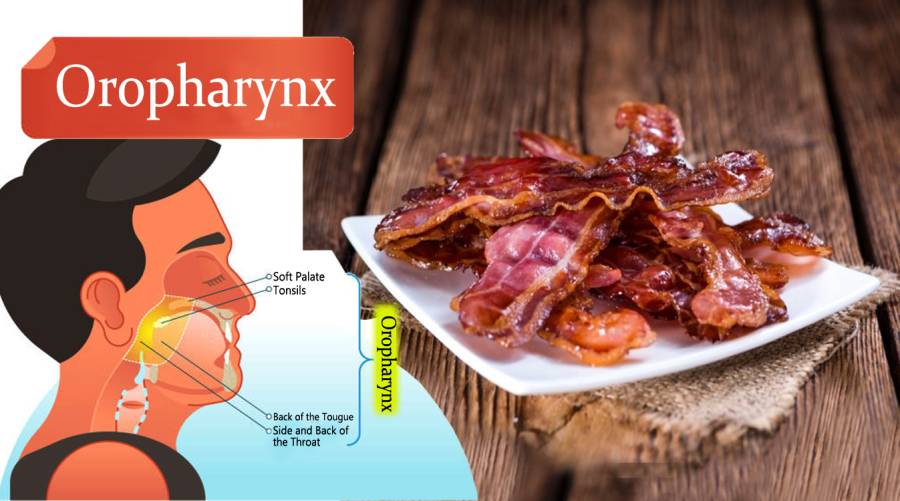 Processed meat use linked to oral cavity, oropharynx cancer