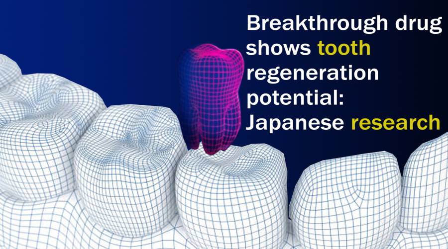 Breakthrough drug shows tooth regeneration potential: Japanese research   