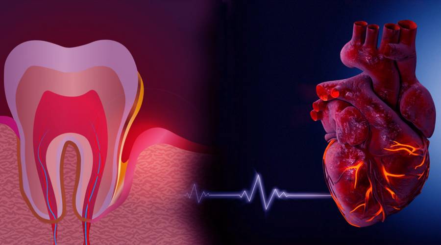 Study explores link between tooth brushing, heart diseases