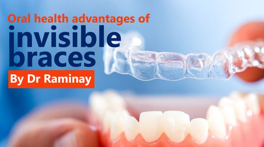 Oral health advantages of invisible braces 