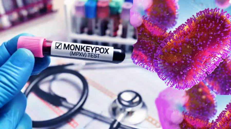 China to manage monkeypox like Covid-19 