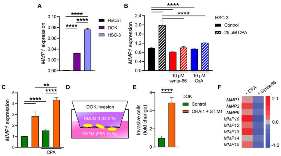 ORAI1 calcium channel identified as key driver of oral cancer growth and pain