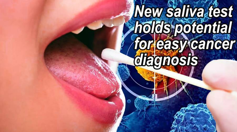 New saliva test holds potential for easy cancer diagnosis 