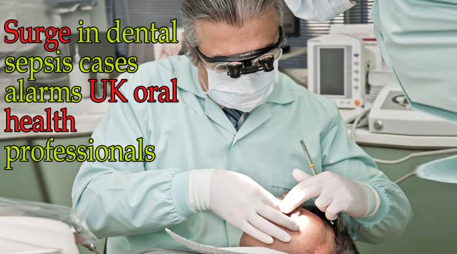 Surge in dental sepsis cases alarms UK oral health professionals 