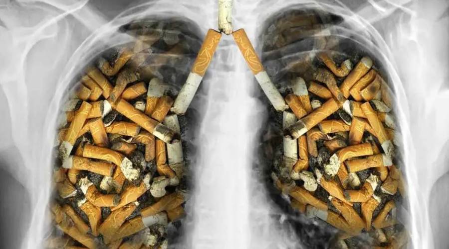 Quitting smoking early linked to better survival rates in lung cancer patients