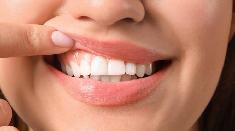 For your teeth’s sake: Dentists warn against these 6 foods, drinks