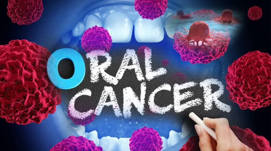 How dentists help identify oral cancer