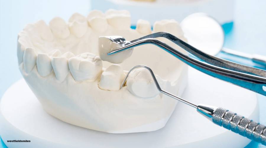 How long do dental hygiene instruments last? A guide to longevity, maintenance