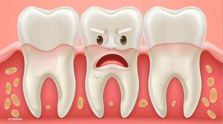 Periodontitis: Causes, symptoms, and prevention tips for healthy gums