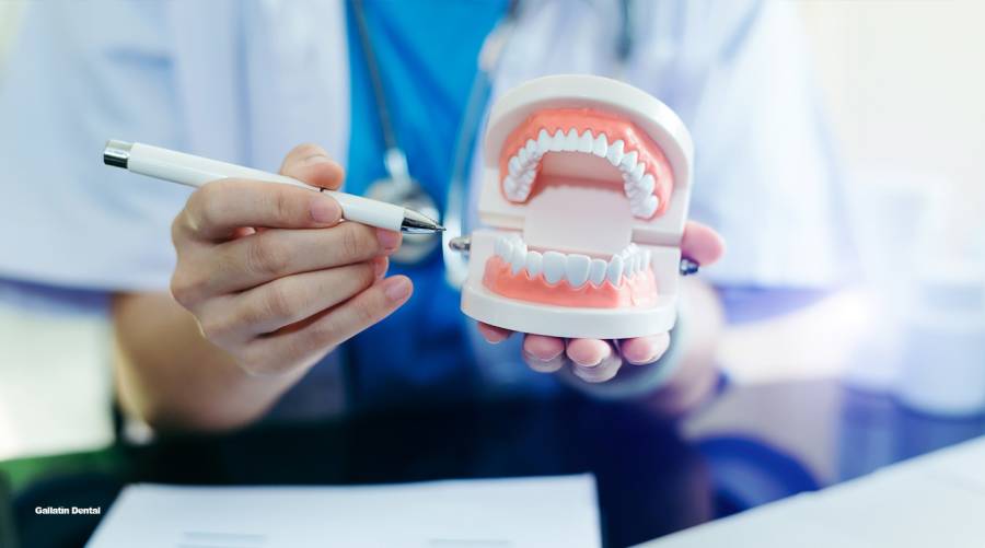 The hidden truth about dental cleanings: How long should you expect?