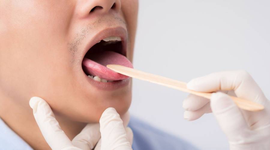 Close-up of a human tongue showing signs of irritation and tingling sensation.