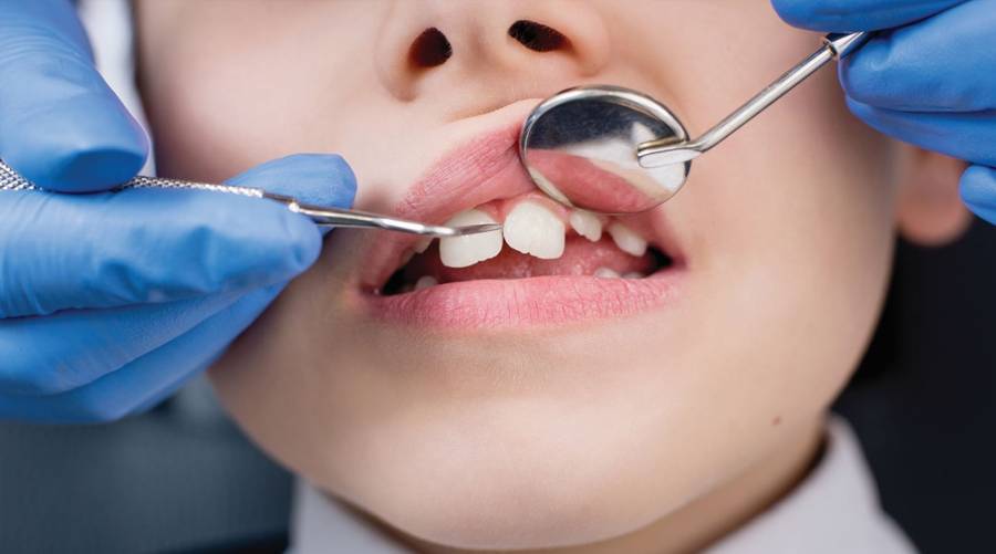 A dental professional examining a child's teeth in a clinical setting, highlighting concerns over NHS dental care and rising hospital extractions.